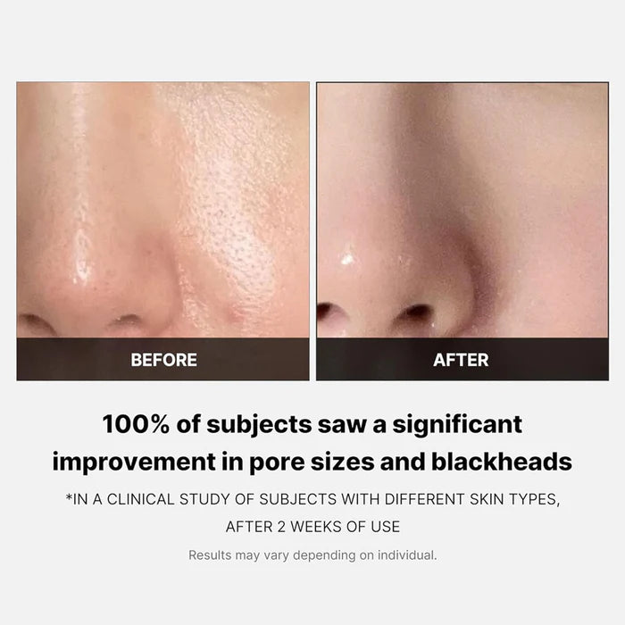 MEDICUBE Zero Pore-pads 2.0 